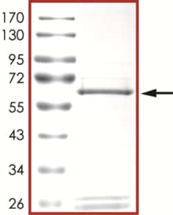 Sino Biological&nbsp;Recombinant Human TIE-2 Protein (R915C, GST Tag), Active